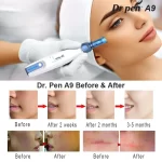 dr. pen a9 ultima microneedling pen avant et après