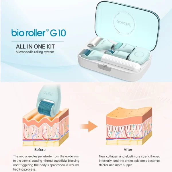 Bio Roller G10 Dermaroller Avant et après