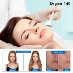 DRS 140A Derma Stamp avant et après